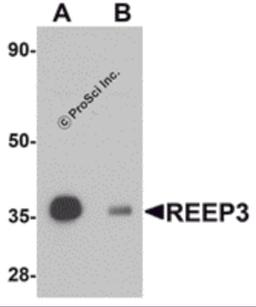 Western blot analysis of REEP3 in rat heart tissue lysate with REEP3 antibody at 1 μg/mL in (A) the absence and (B) the presence of blocking peptide.