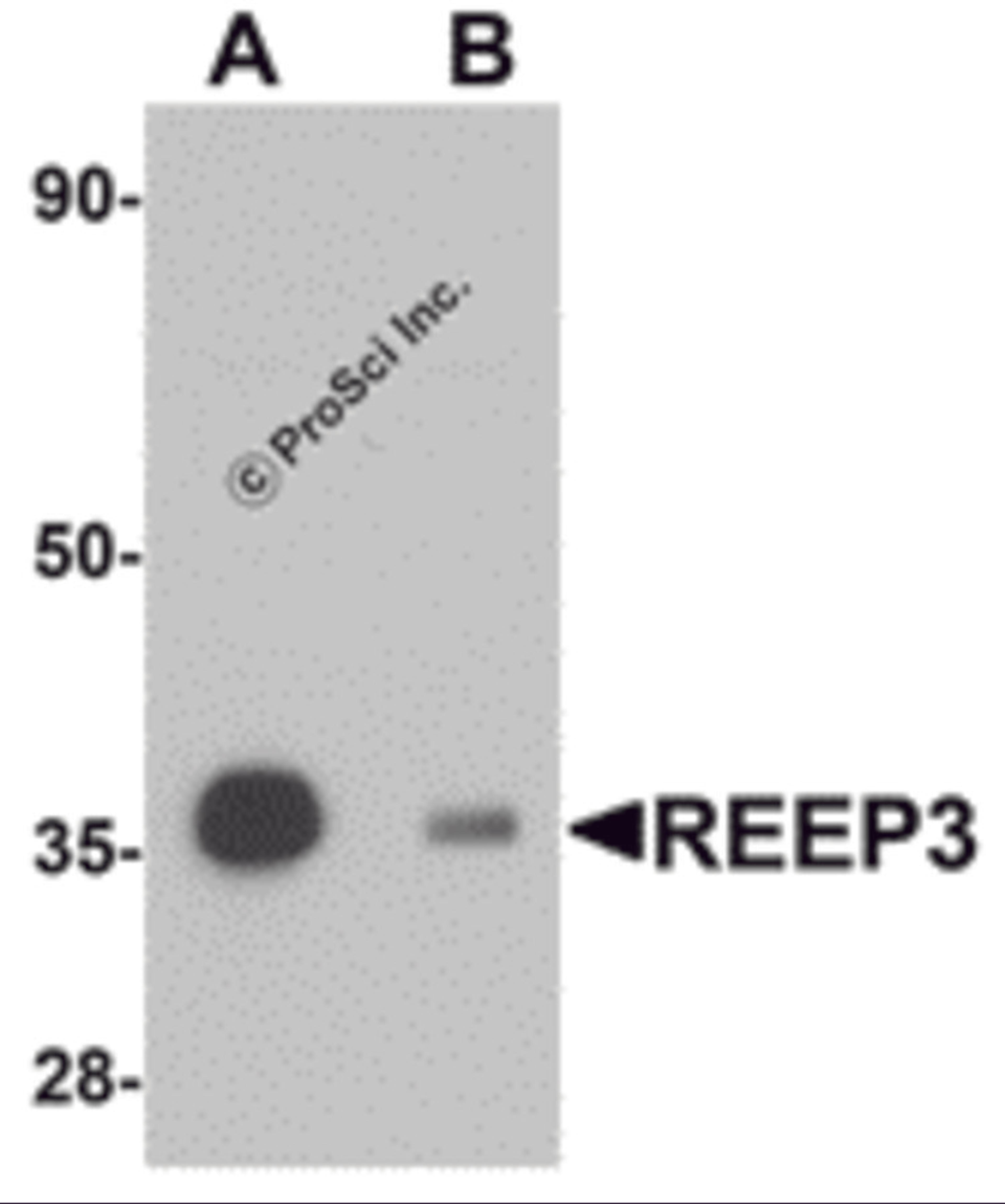 Western blot analysis of REEP3 in rat heart tissue lysate with REEP3 antibody at 1 μg/mL in (A) the absence and (B) the presence of blocking peptide.