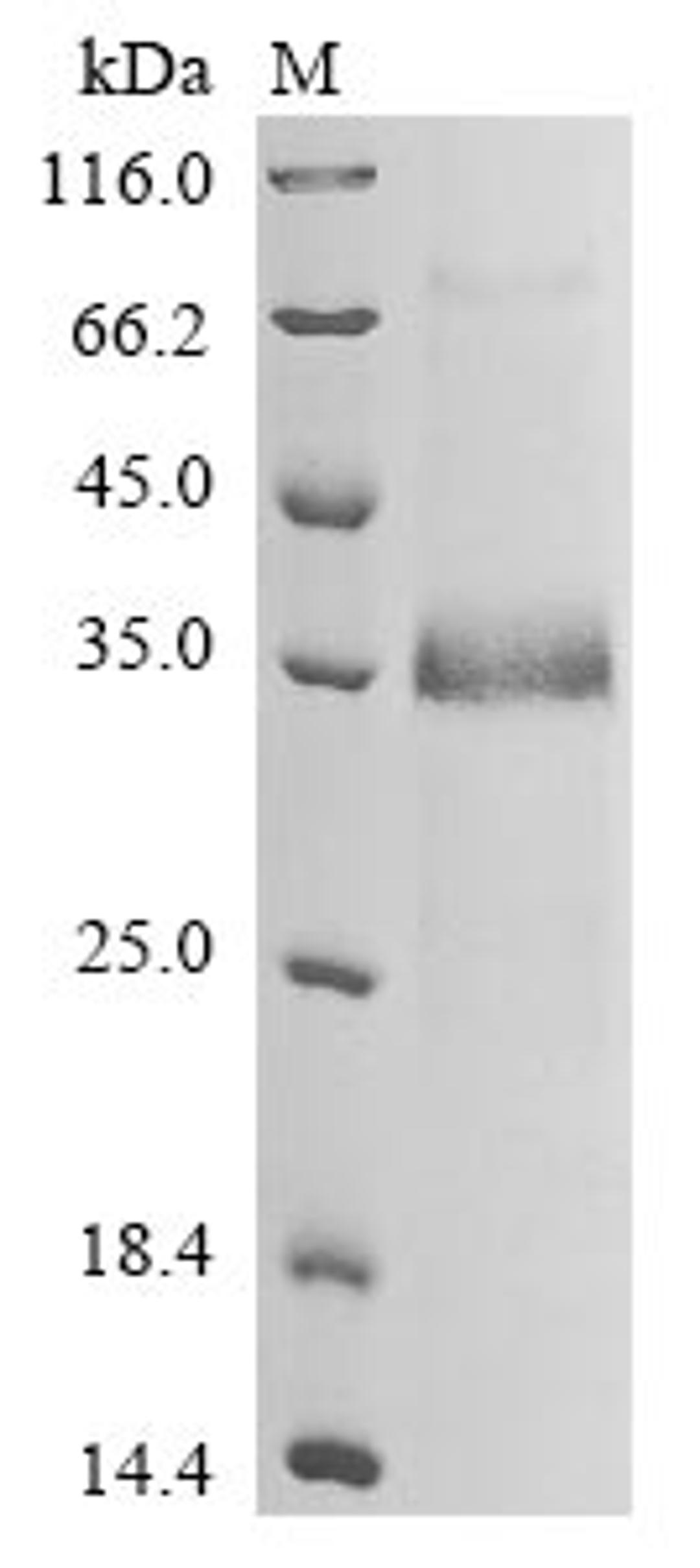 (Tris-Glycine gel) Discontinuous SDS-PAGE (reduced) with 5% enrichment gel and 15% separation gel.