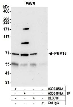 Detection of human PRMT5 by western blot of immunoprecipitates.