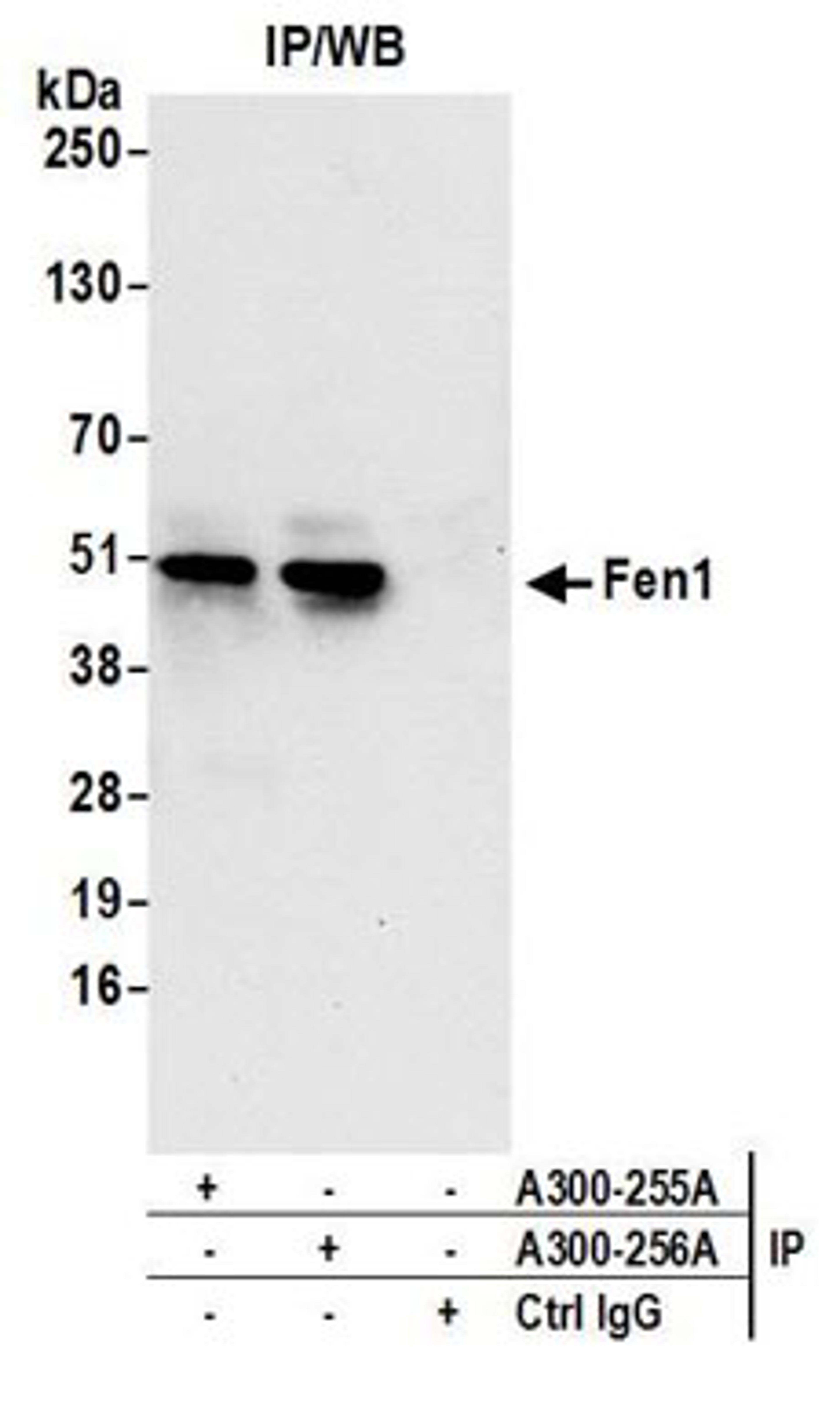 Detection of human Fen1 by western blot of immunoprecipitates.