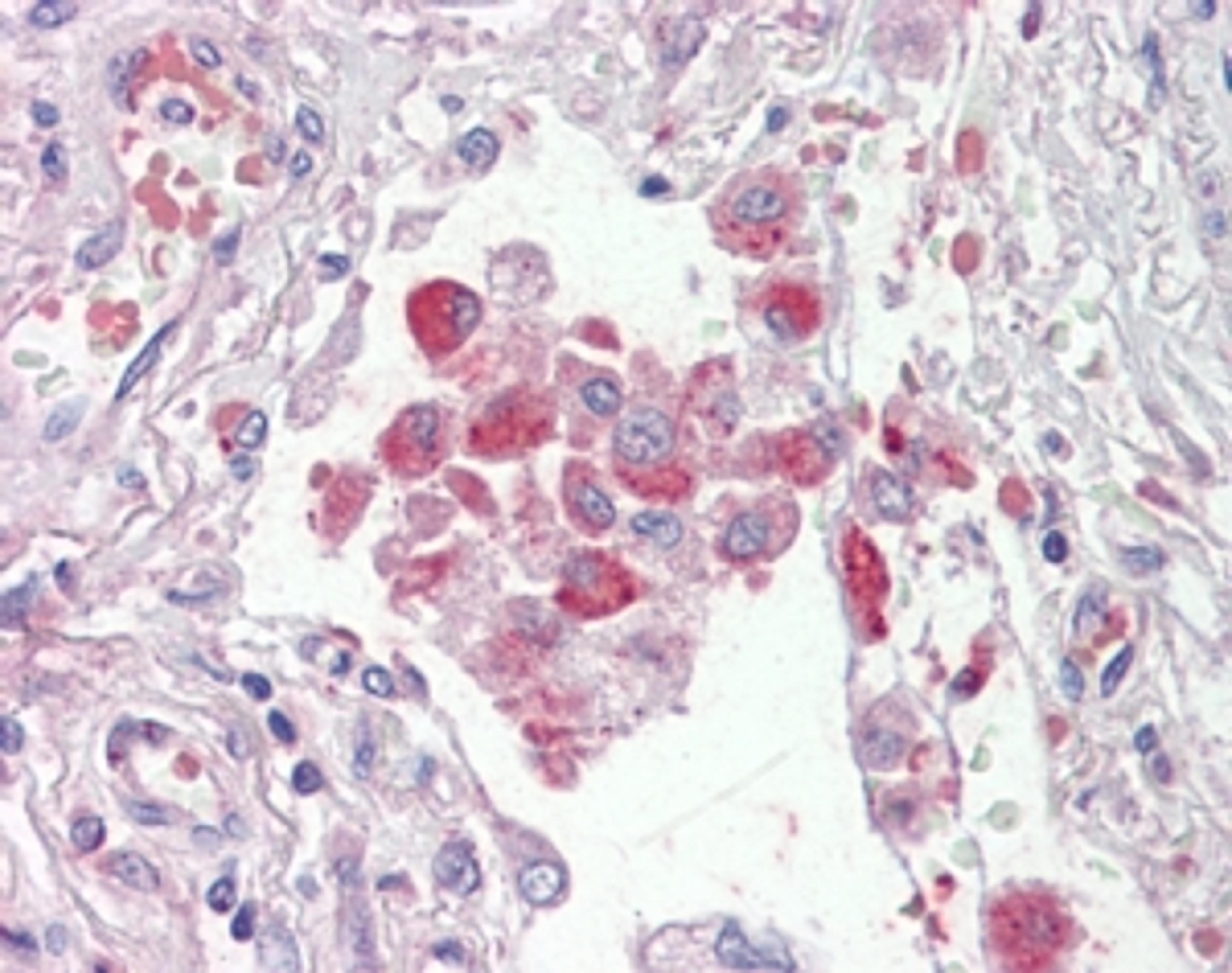 46-112 (2.5ug/ml) staining of paraffin embedded Human Lung. Steamed antigen retrieval with citrate buffer pH 6, AP-staining.