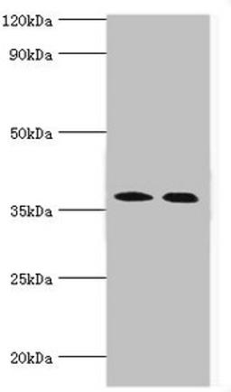 Western blot. All lanes: Carbonic anhydrase 14 antibody at 5ug/ml. Lane 1: Mouse liver tissue. Lane 2: Jurkat whole cell lysate. Secondary. Goat polyclonal to rabbit IgG at 1/10000 dilution. Predicted band size: 38 kDa. Observed band size: 38 kDa. 