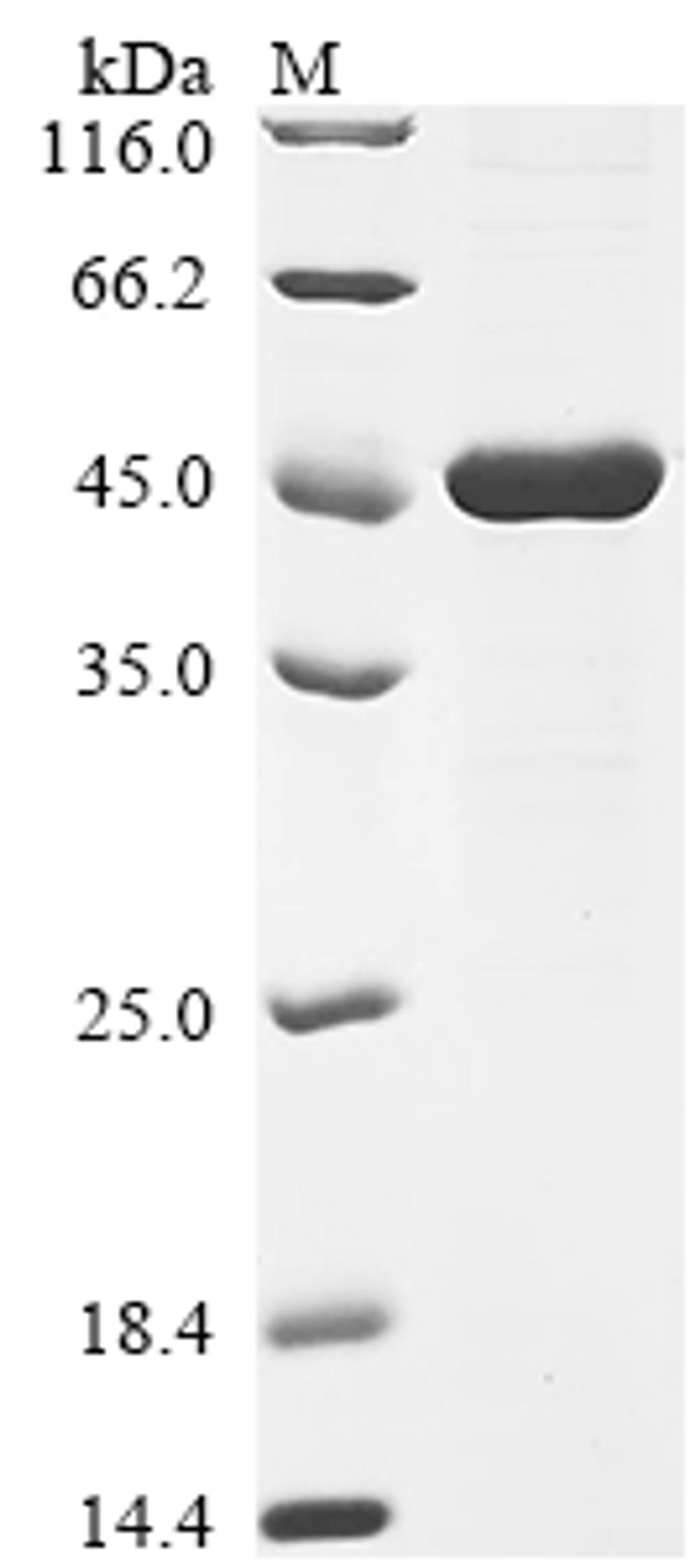 (Tris-Glycine gel) Discontinuous SDS-PAGE (reduced) with 5% enrichment gel and 15% separation gel.