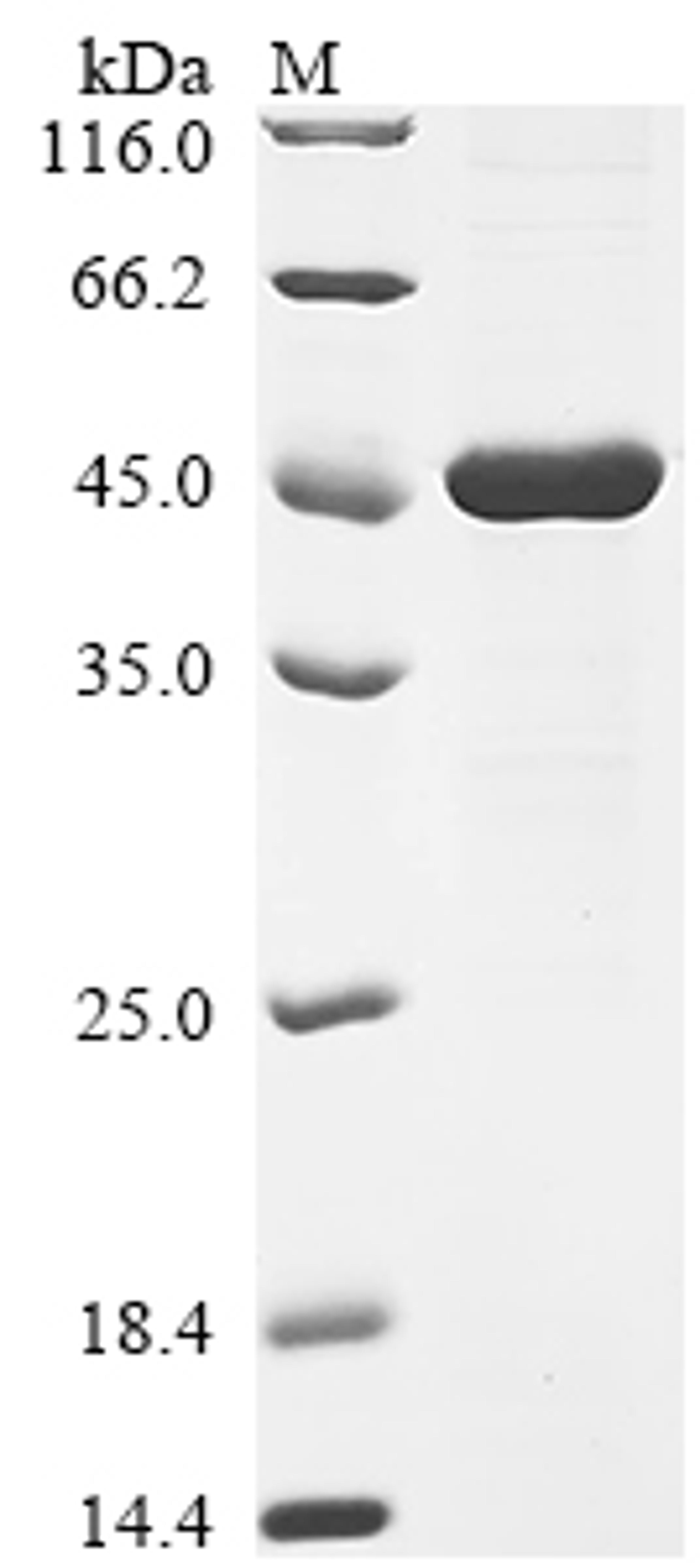 (Tris-Glycine gel) Discontinuous SDS-PAGE (reduced) with 5% enrichment gel and 15% separation gel.