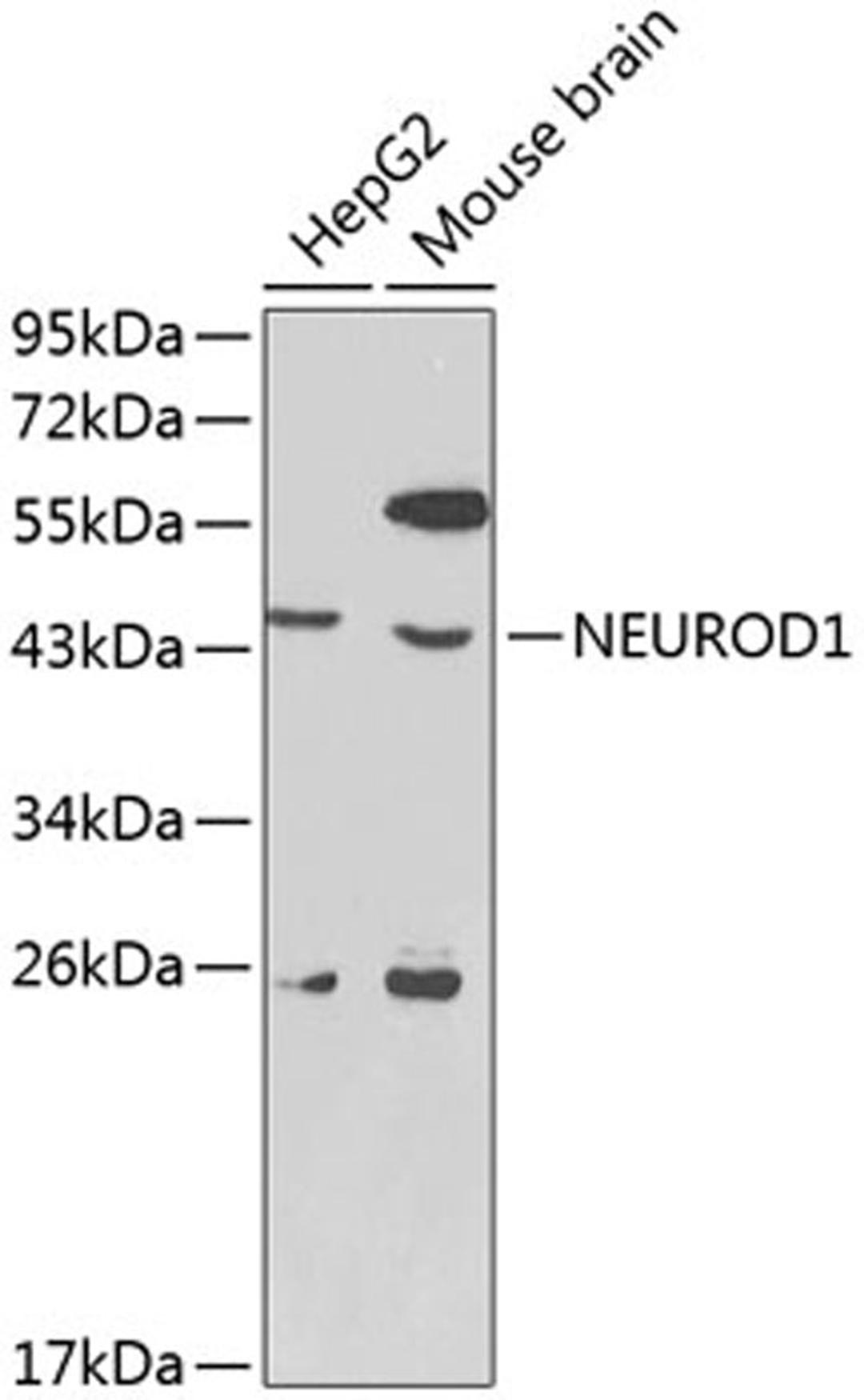 Western blot - NEUROD1 antibody (A1147)