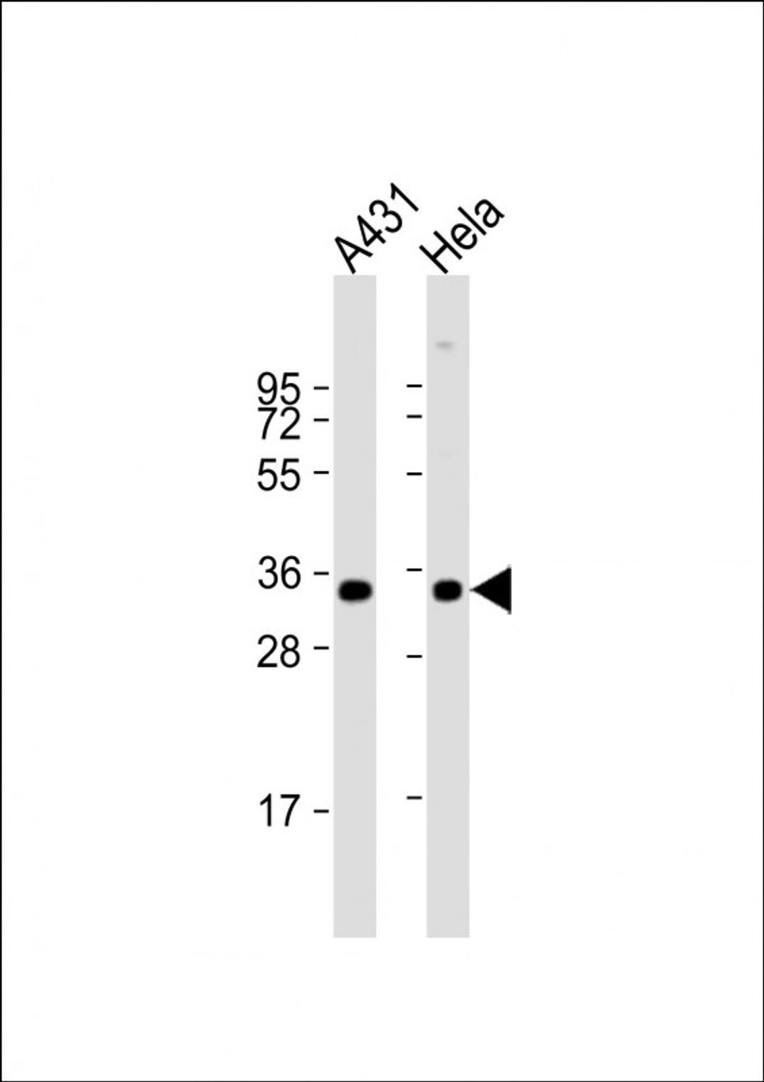 Western Blot at 1:1000 dilution Lane 1: A431 whole cell lysate Lane 2: Hela whole cell lysate Lysates/proteins at 20 ug per lane.