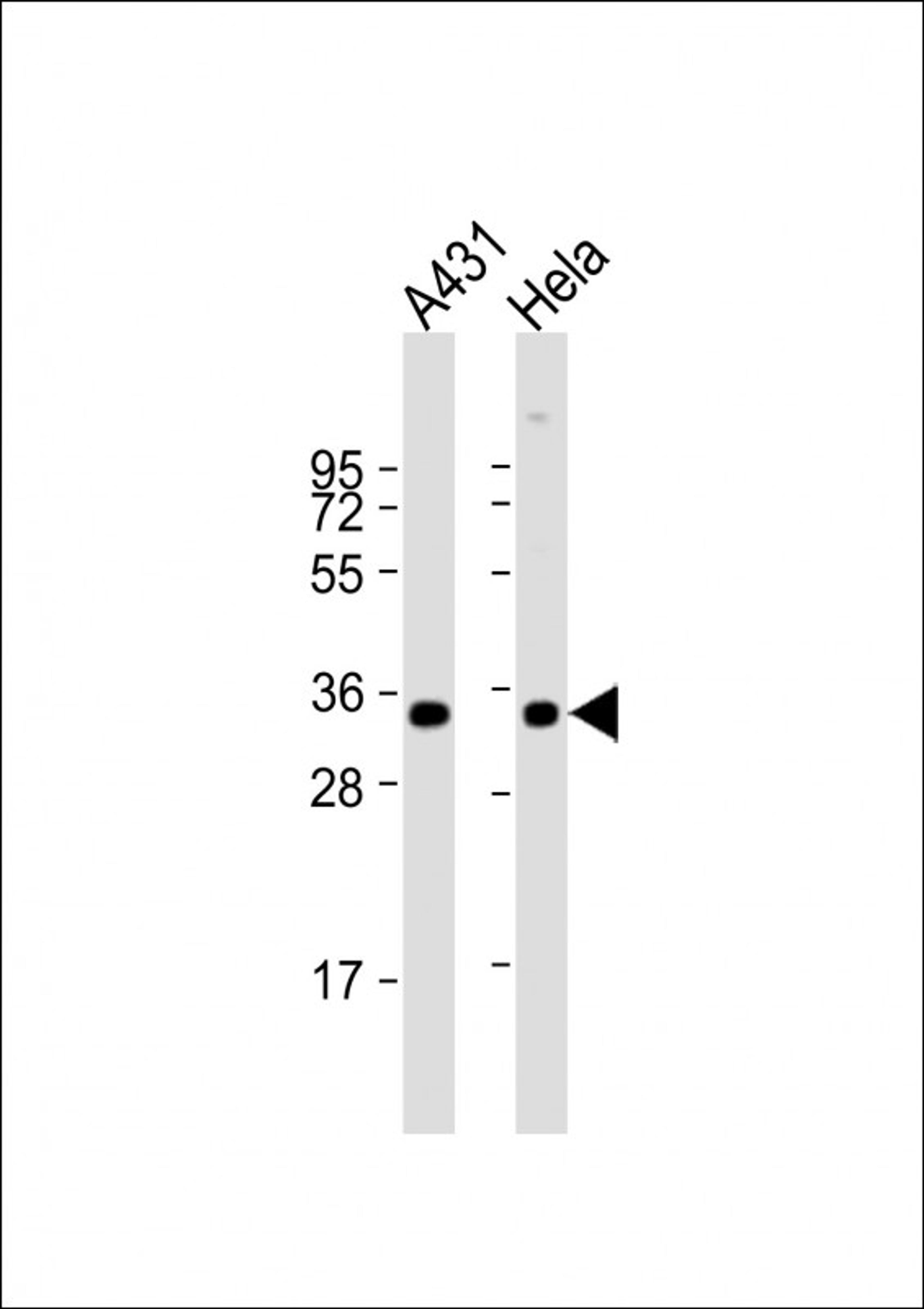 Western Blot at 1:1000 dilution Lane 1: A431 whole cell lysate Lane 2: Hela whole cell lysate Lysates/proteins at 20 ug per lane.