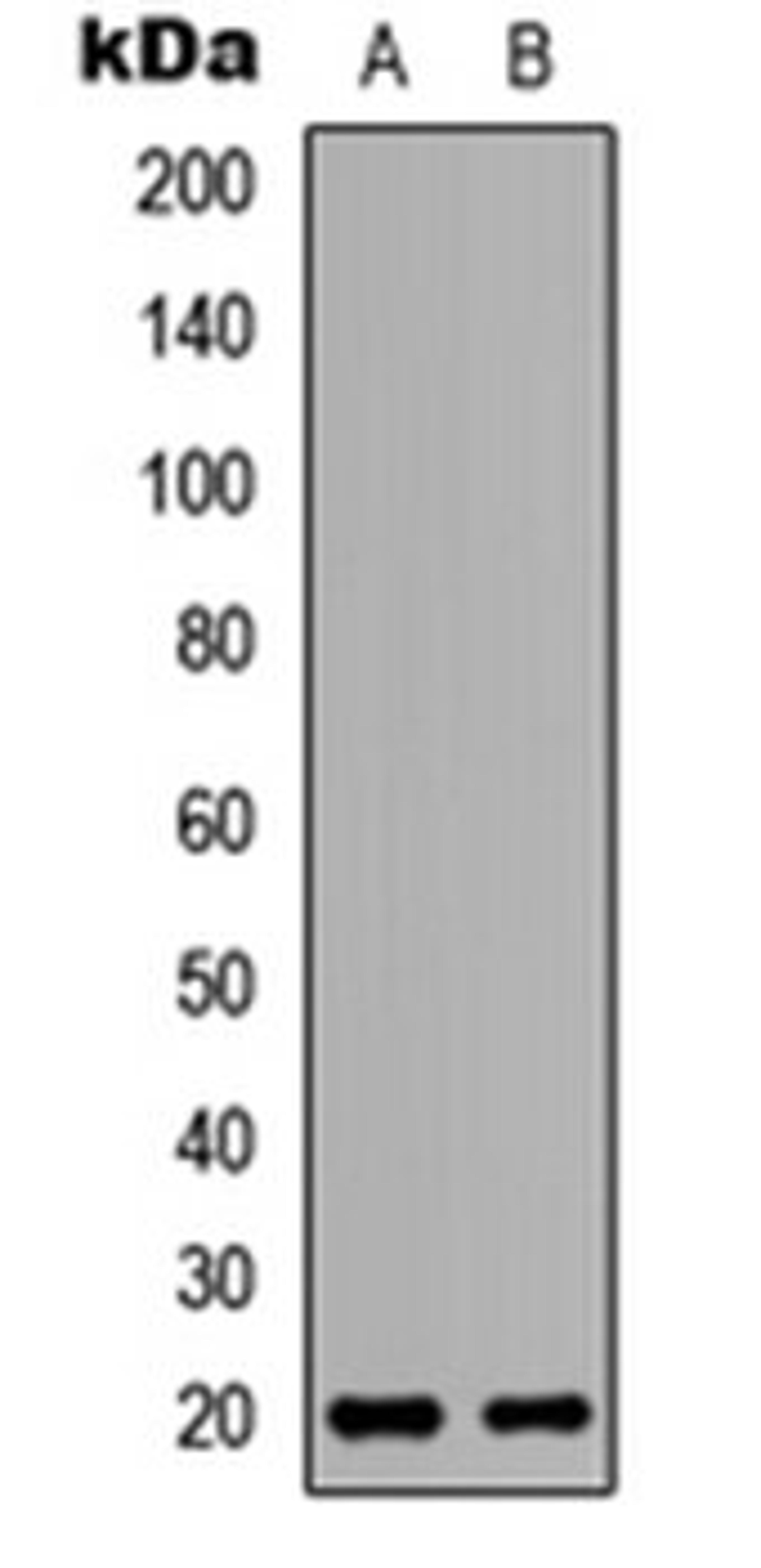 Western blot analysis of HeLa (Lane 1), H9C2 (Lane 2) whole cell lysates using BinCARD antibody