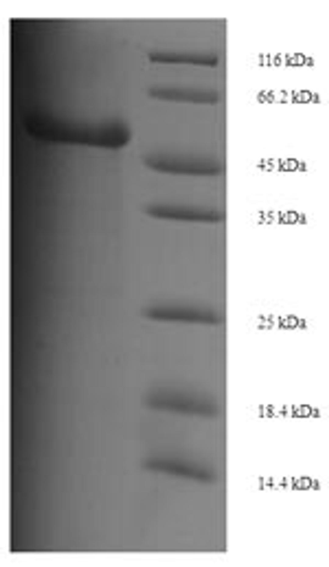 (Tris-Glycine gel) Discontinuous SDS-PAGE (reduced) with 5% enrichment gel and 15% separation gel.