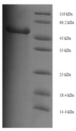 (Tris-Glycine gel) Discontinuous SDS-PAGE (reduced) with 5% enrichment gel and 15% separation gel.