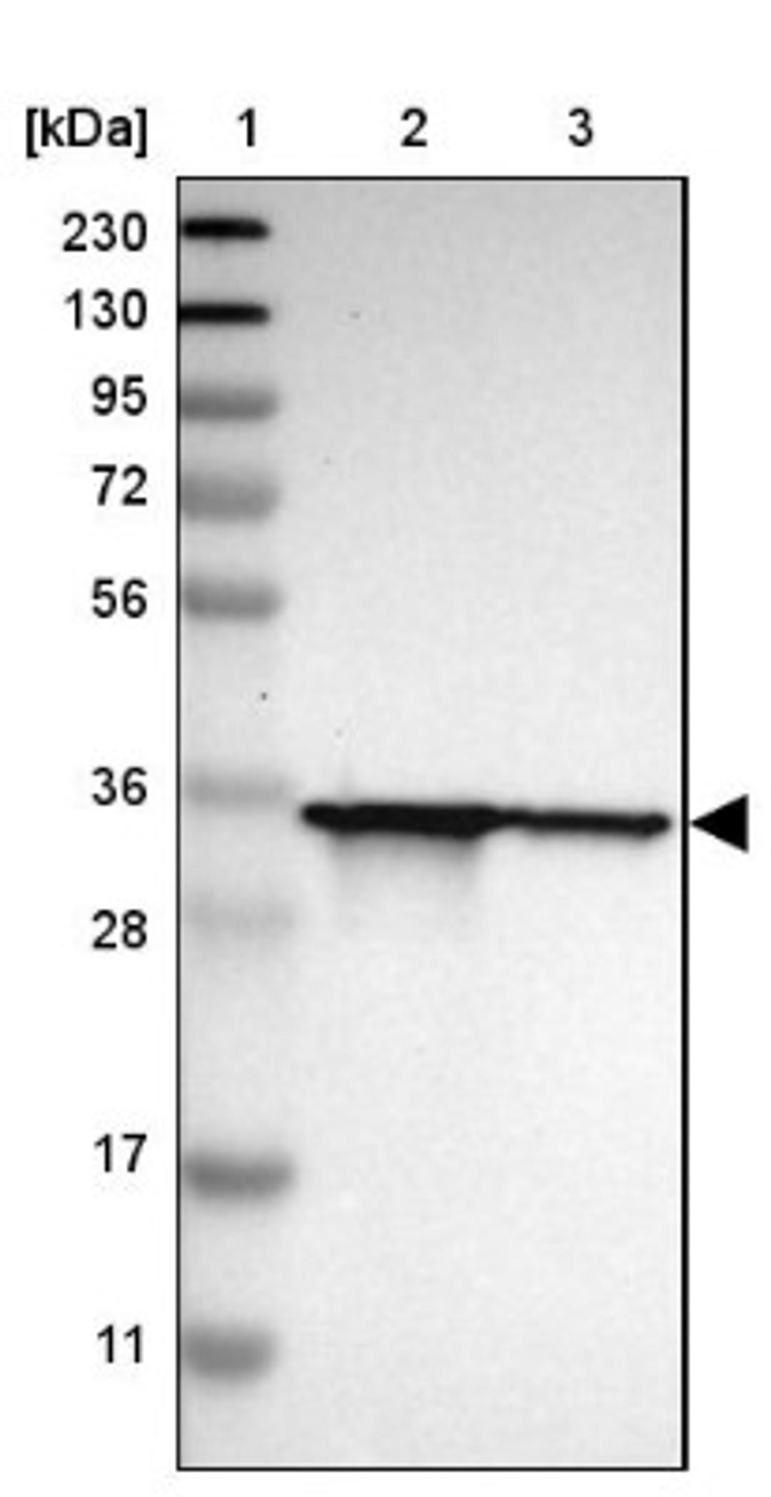 Western Blot: TWSG1 Antibody [NBP1-80660] - Lane 1: Marker [kDa] 230, 130, 95, 72, 56, 36, 28, 17, 11<br/>Lane 2: Human cell line RT-4<br/>Lane 3: Human cell line U-251MG sp