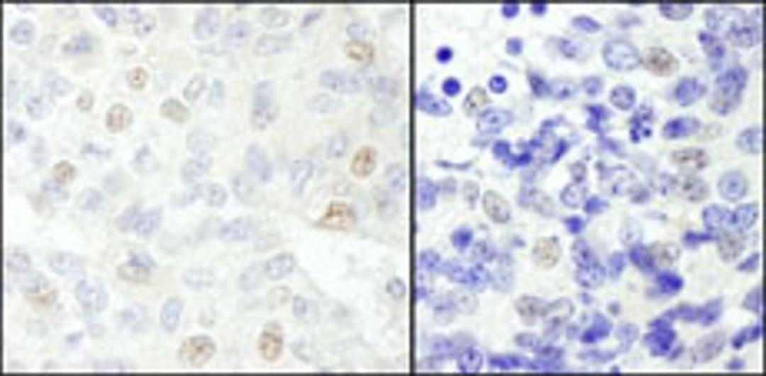 Detection of human and mouse NCOA62 by immunohistochemistry.