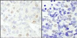 Detection of human and mouse NCOA62 by immunohistochemistry.