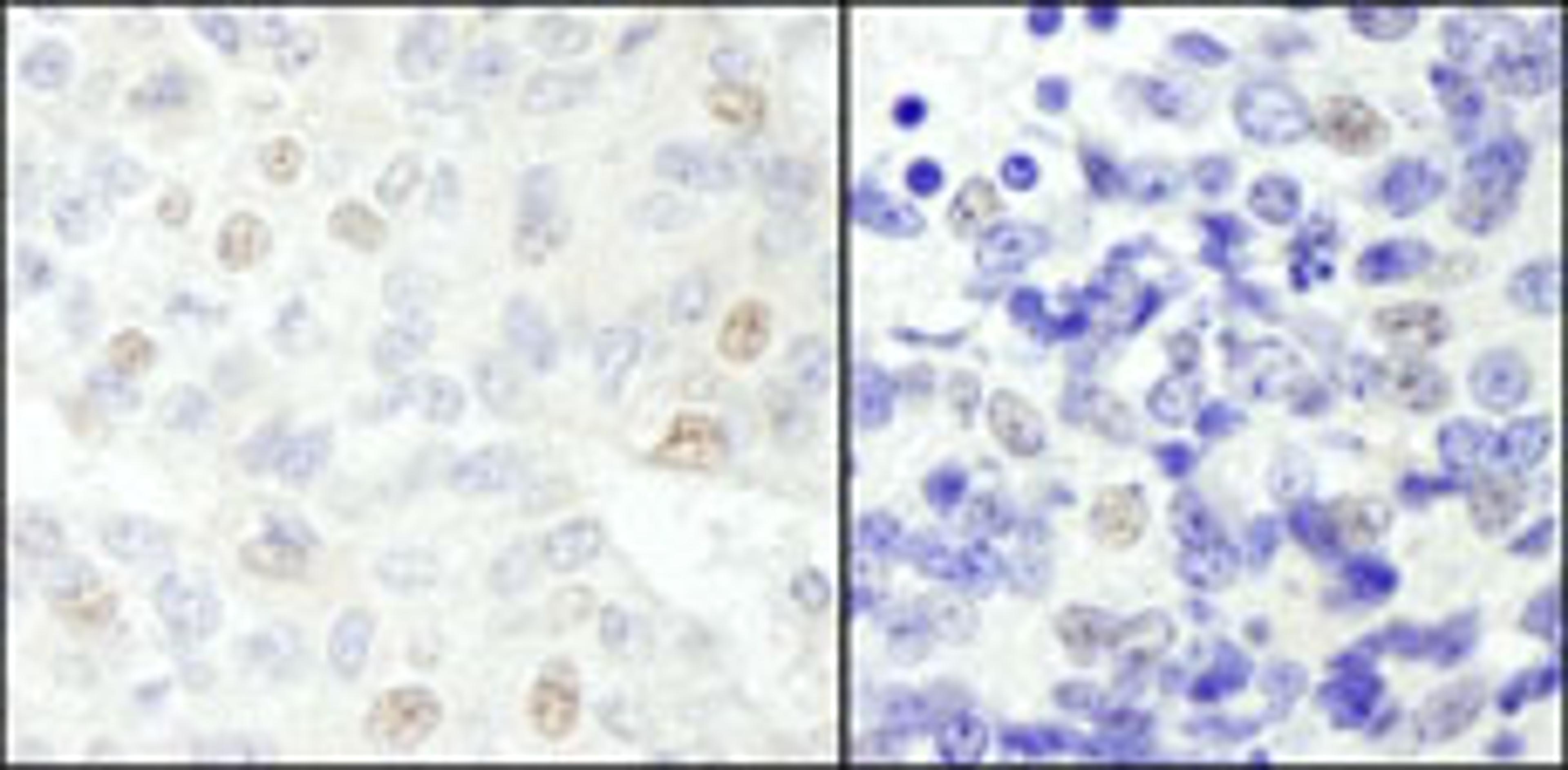 Detection of human and mouse NCOA62 by immunohistochemistry.