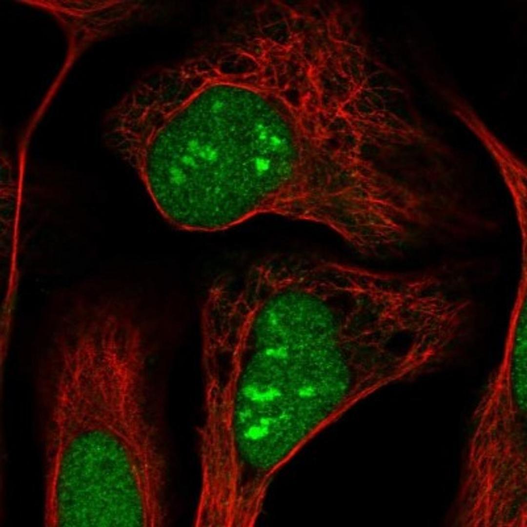 Immunocytochemistry/Immunofluorescence: DNAJC8 Antibody [NBP1-87015] - Immunofluorescent staining of human cell line U-2 OS shows positivity in nucleus & nucleoli.