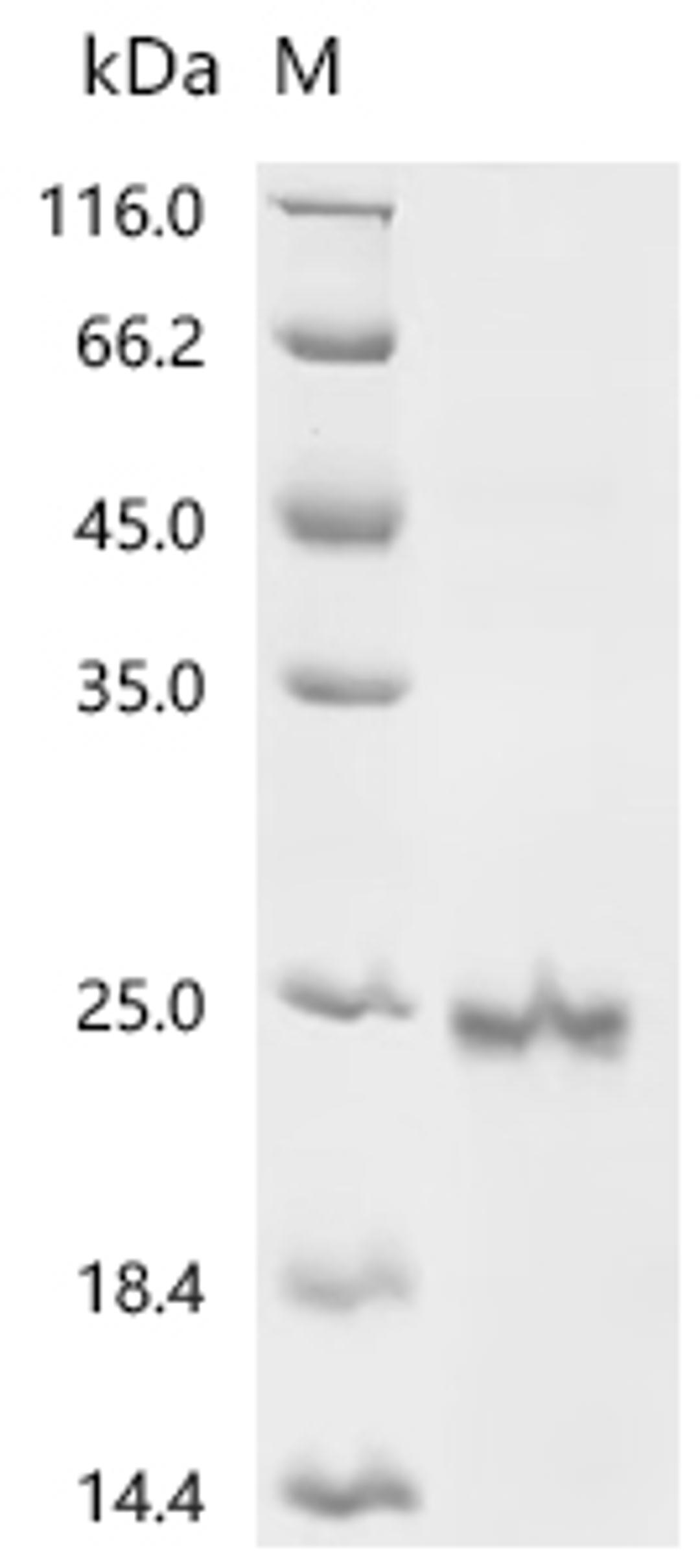 (Tris-Glycine gel) Discontinuous SDS-PAGE (reduced) with 5% enrichment gel and 15% separation gel.
