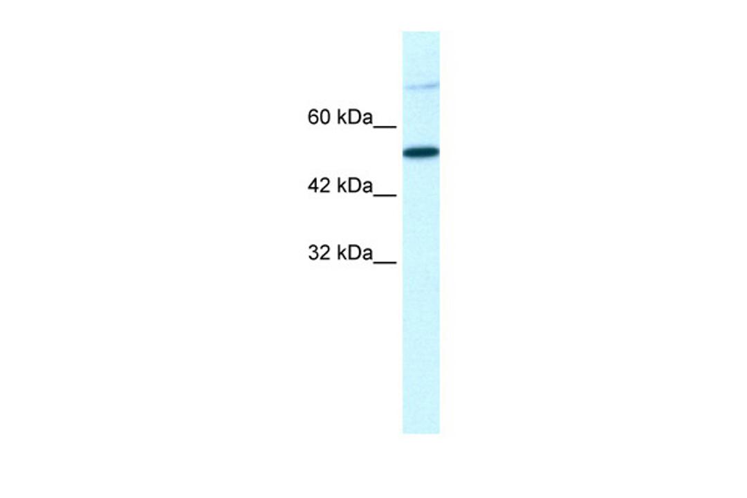 Antibody used in WB on Human HepG2 at 1.25 ug/ml.