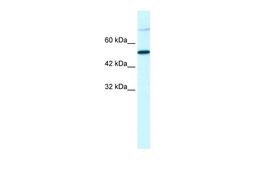 Antibody used in WB on Human HepG2 at 1.25 ug/ml.