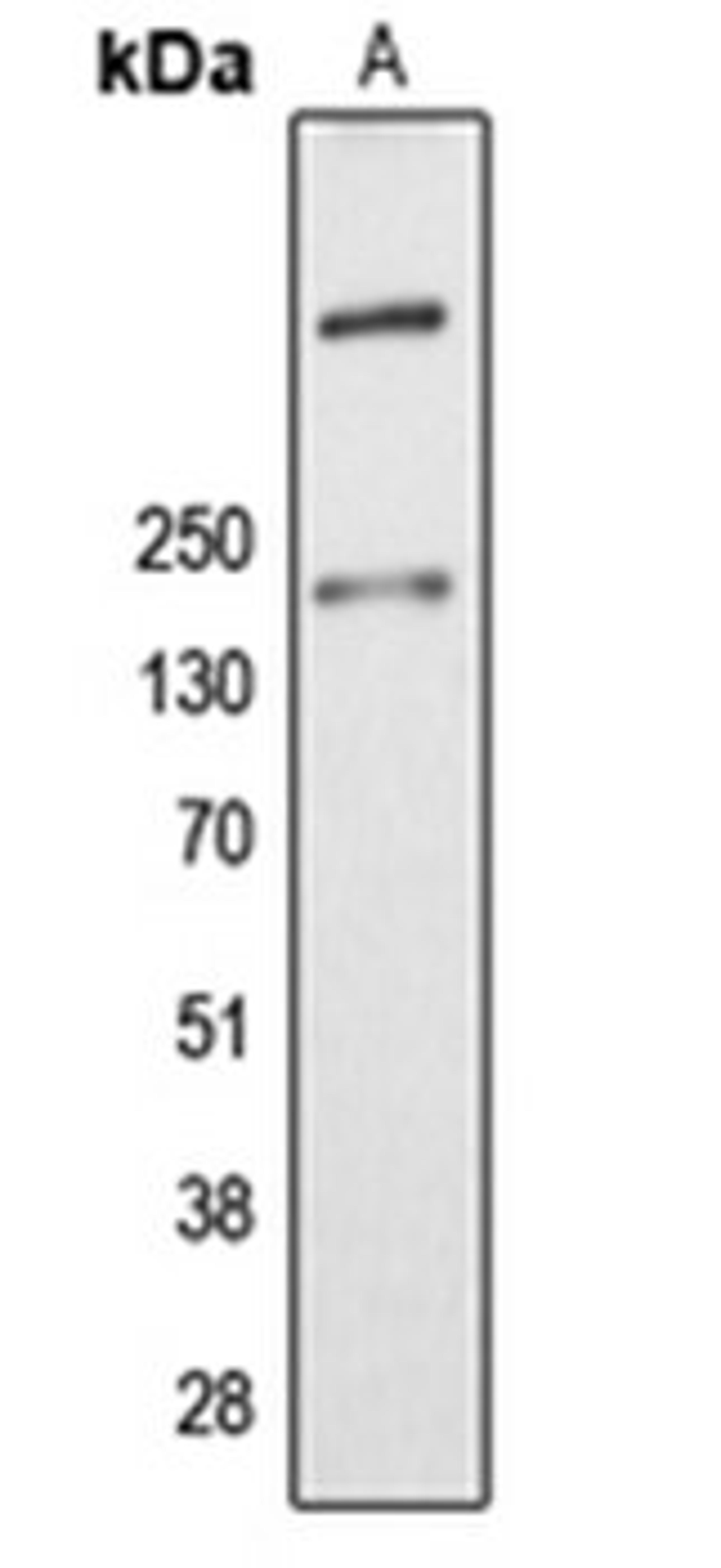 Western blot analysis of K562 (Lane 1) whole cell lysates using ALMS1 antibody