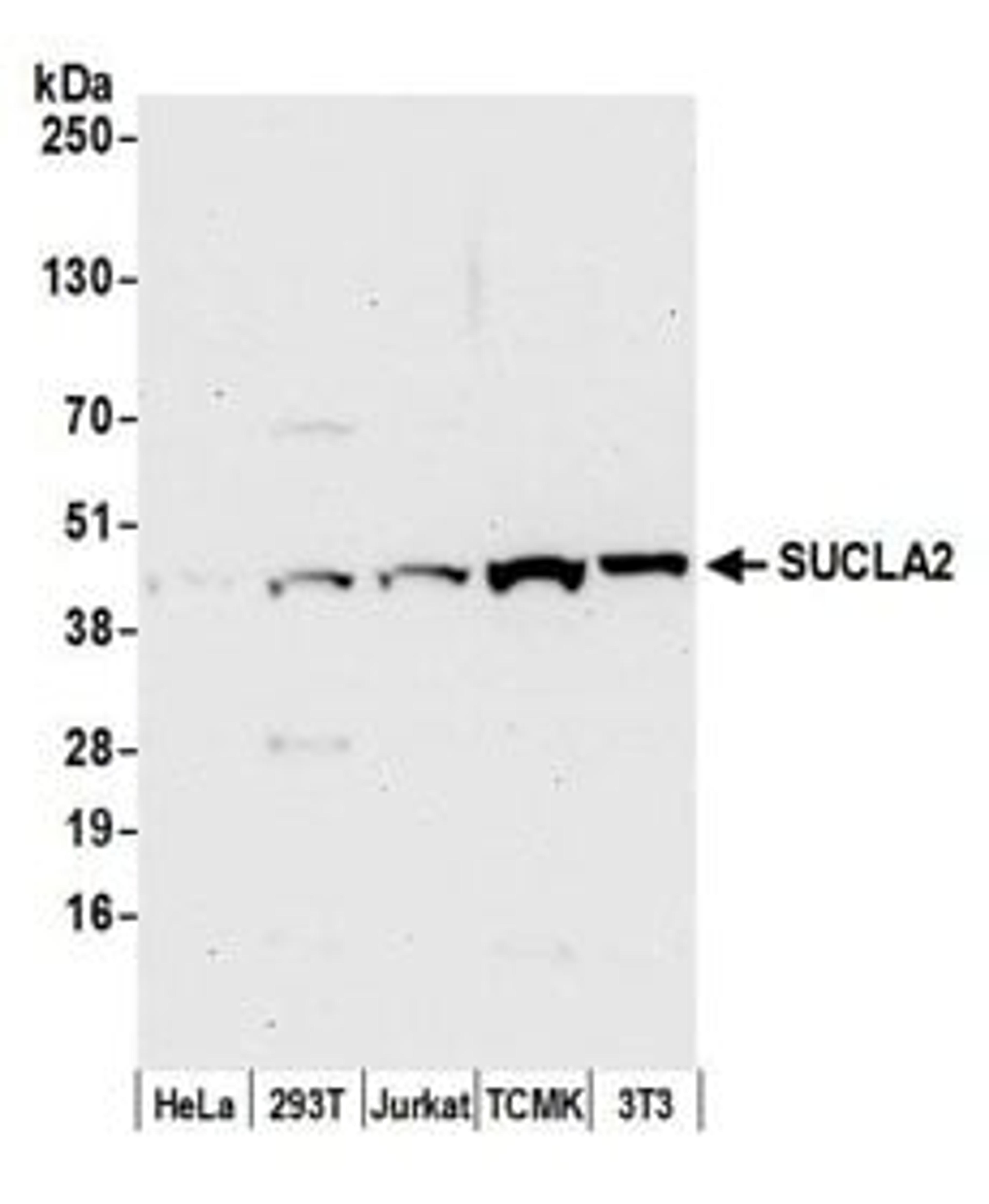 Detection of human and mouse SUCLA2 by western blot.