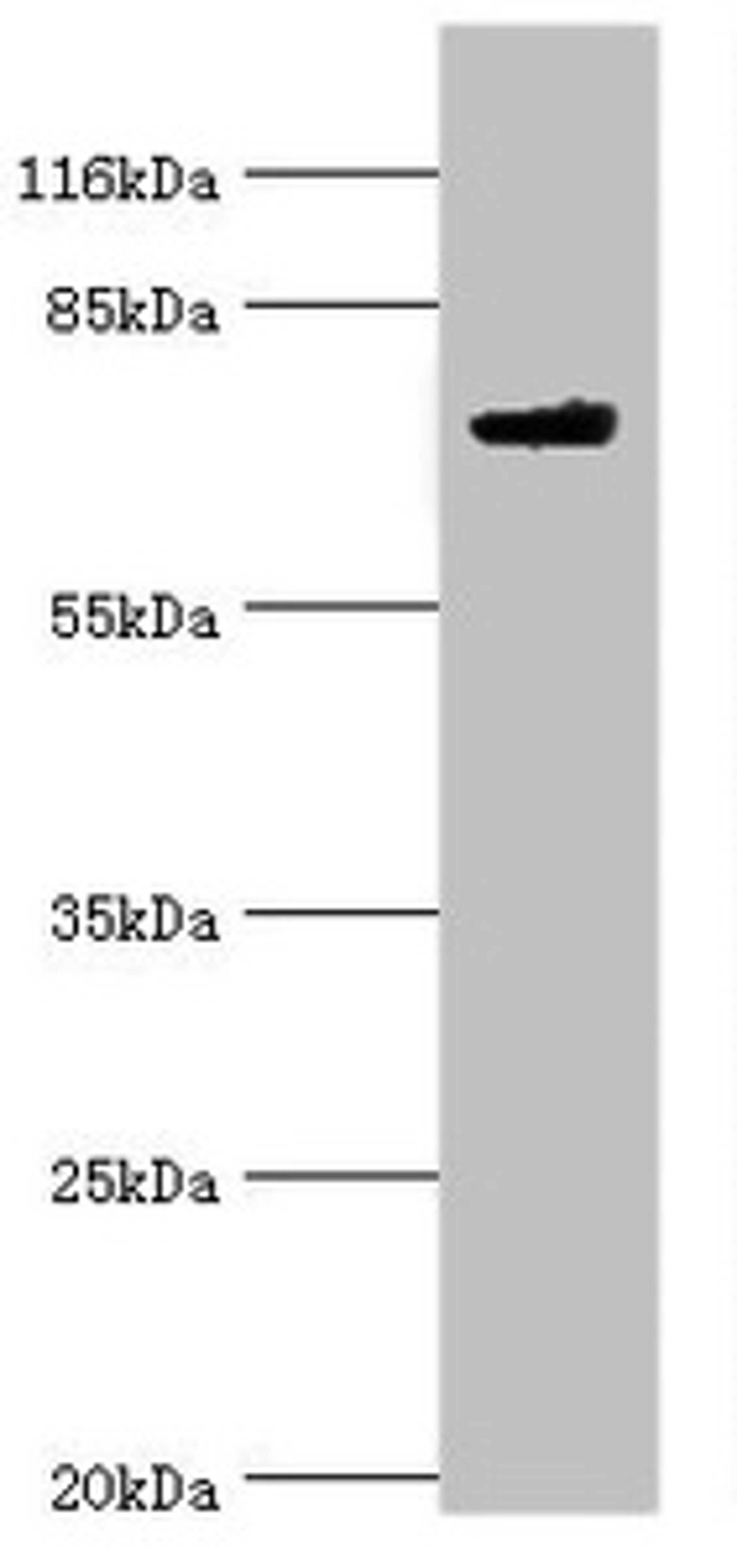 Western blot. All lanes: MTMR7 antibody at 2µg/ml + Mouse brain tissue. Secondary. Goat polyclonal to rabbit IgG at 1/10000 dilution. Predicted band size: 76, 65 kDa. Observed band size: 76 kDa