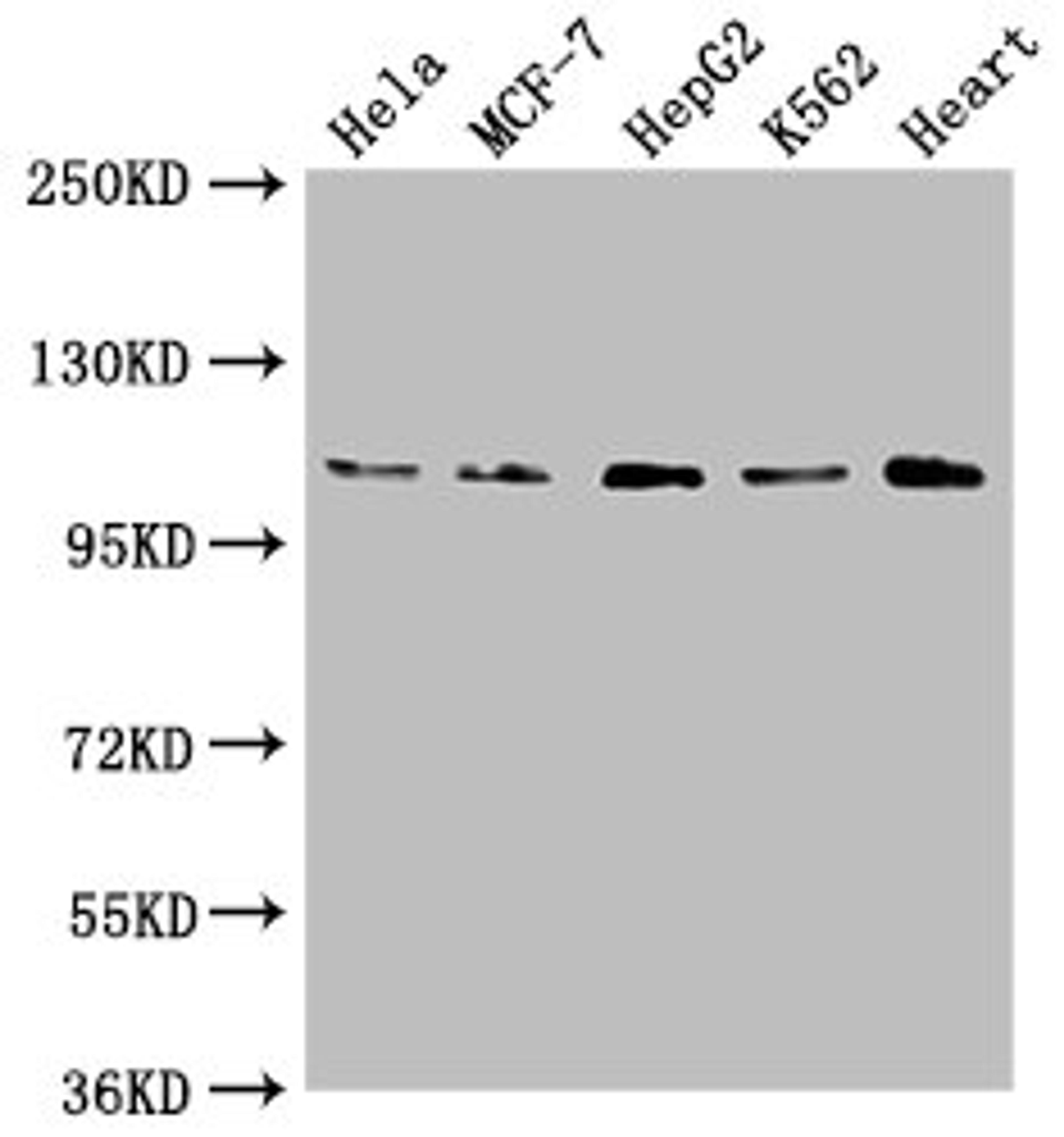 Western Blot. Positive WB detected in: Hela whole cell lysate, MCF-7 whole cell lysate, HepG2 whole cell lysate, K562 whole cell lysate, Mouse heart tissue. All lanes: OPA1 antibody at 1:2000. Secondary. Goat polyclonal to rabbit IgG at 1/50000 dilution. Predicted band size: 112, 116 kDa. Observed band size: 112 kDa. 