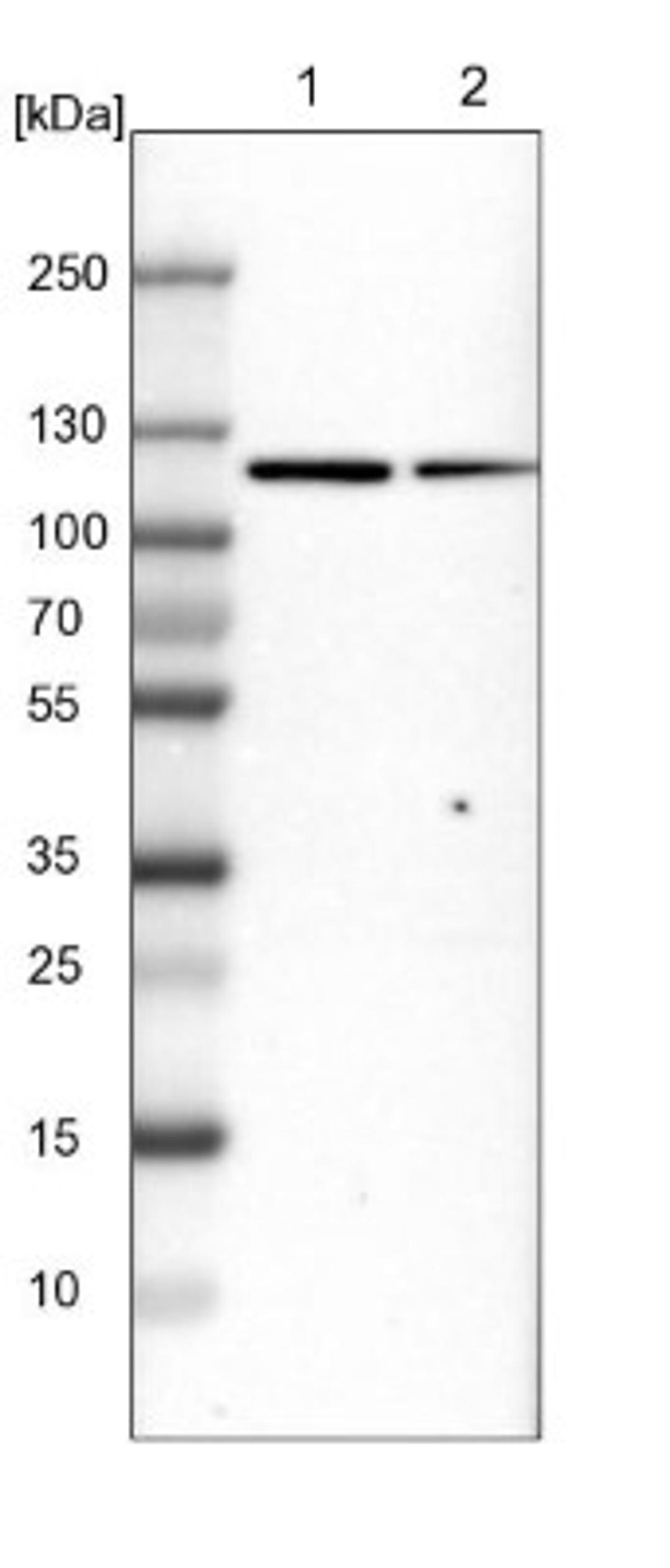 Western Blot: MTHFD1 Antibody [NBP1-82612] - Lane 1: NIH-3T3 cell lysate (Mouse embryonic fibroblast cells)<br/>Lane 2: NBT-II cell lysate (Rat Wistar bladder tumour cells)