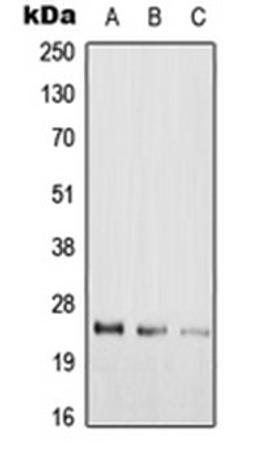 Western blot analysis of Hela (Lane 1), rat lung (Lane 2), H9C2 (Lane 3) whole cell lysates using RAB39A antibody