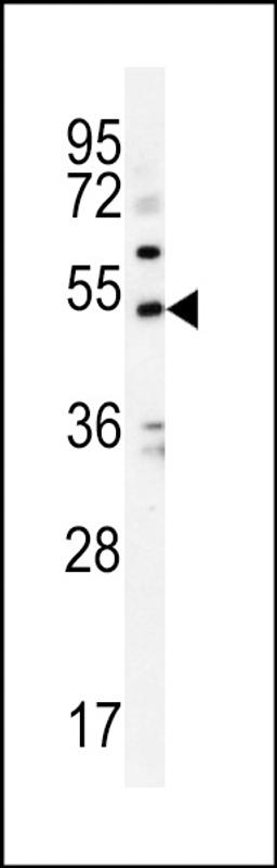 Western blot analysis in K562 cell line lysates (35ug/lane).