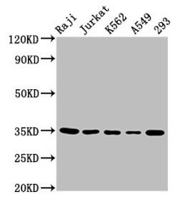 Western Blot. Positive WB detected in: Raji whole cell lysate, Jurkat whole cell lysate, K562 whole cell lysate, A549 whole cell lysate, 293 whole cell lysate. All lanes: TAL1 antibody at 5.5µg/ml. Secondary. Goat polyclonal to rabbit IgG at 1/50000 dilution. Predicted band size: 35, 32, 17 kDa. Observed band size: 35 kDa