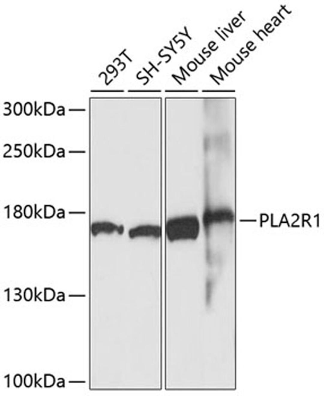 Western blot - PLA2R1 antibody (A10068)