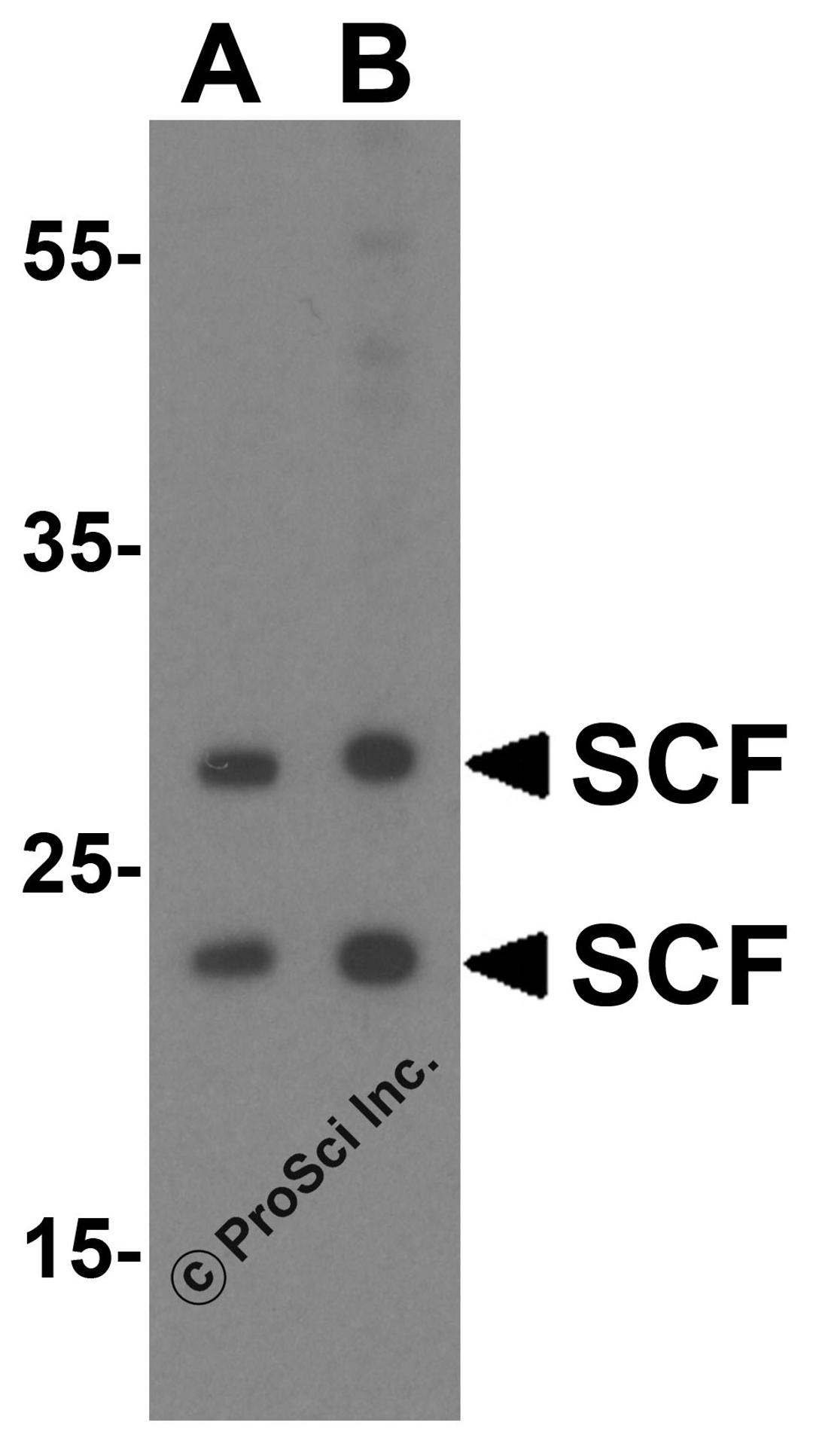 Western blot analysis of SCF in A431 cell lysate with SCF antibody at (A) 1 and (B) 2 &#956;g/mL.