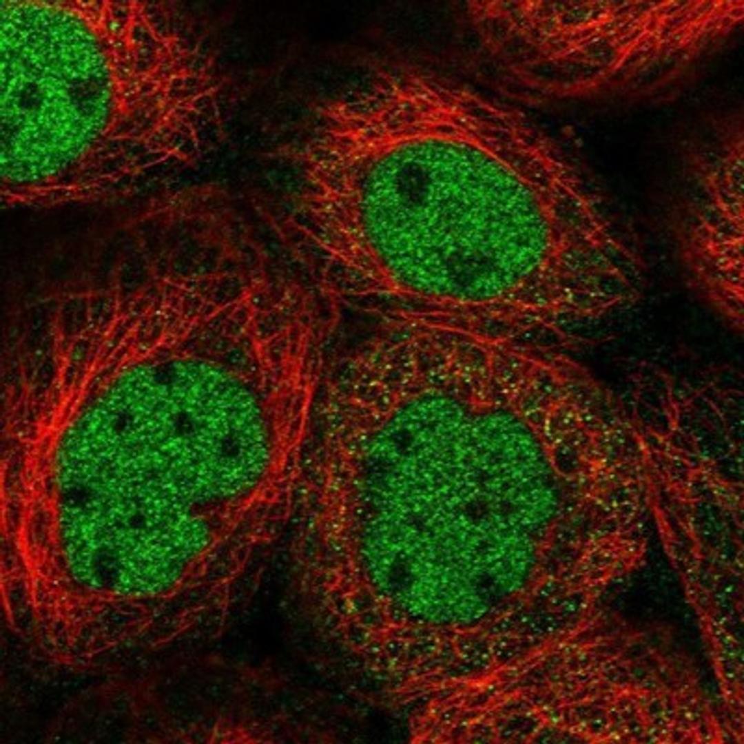 Immunocytochemistry/Immunofluorescence: DNA helicase HEL308 Antibody [NBP1-91842] - Staining of human cell line A-431 shows positivity in nucleus but not nucleoli.