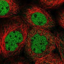 Immunocytochemistry/Immunofluorescence: DNA helicase HEL308 Antibody [NBP1-91842] - Staining of human cell line A-431 shows positivity in nucleus but not nucleoli.