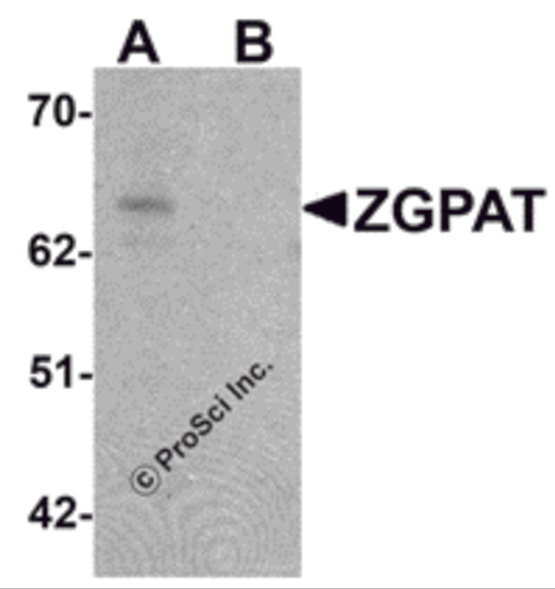 Western blot analysis of ZGPAT in SK-N-SH cell lysate with ZGPAT antibody at 1 μg/mL in (A) the absence and (B) the presence of blocking peptide.