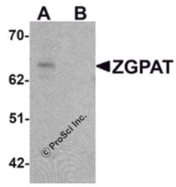 Western blot analysis of ZGPAT in SK-N-SH cell lysate with ZGPAT antibody at 1 μg/mL in (A) the absence and (B) the presence of blocking peptide.