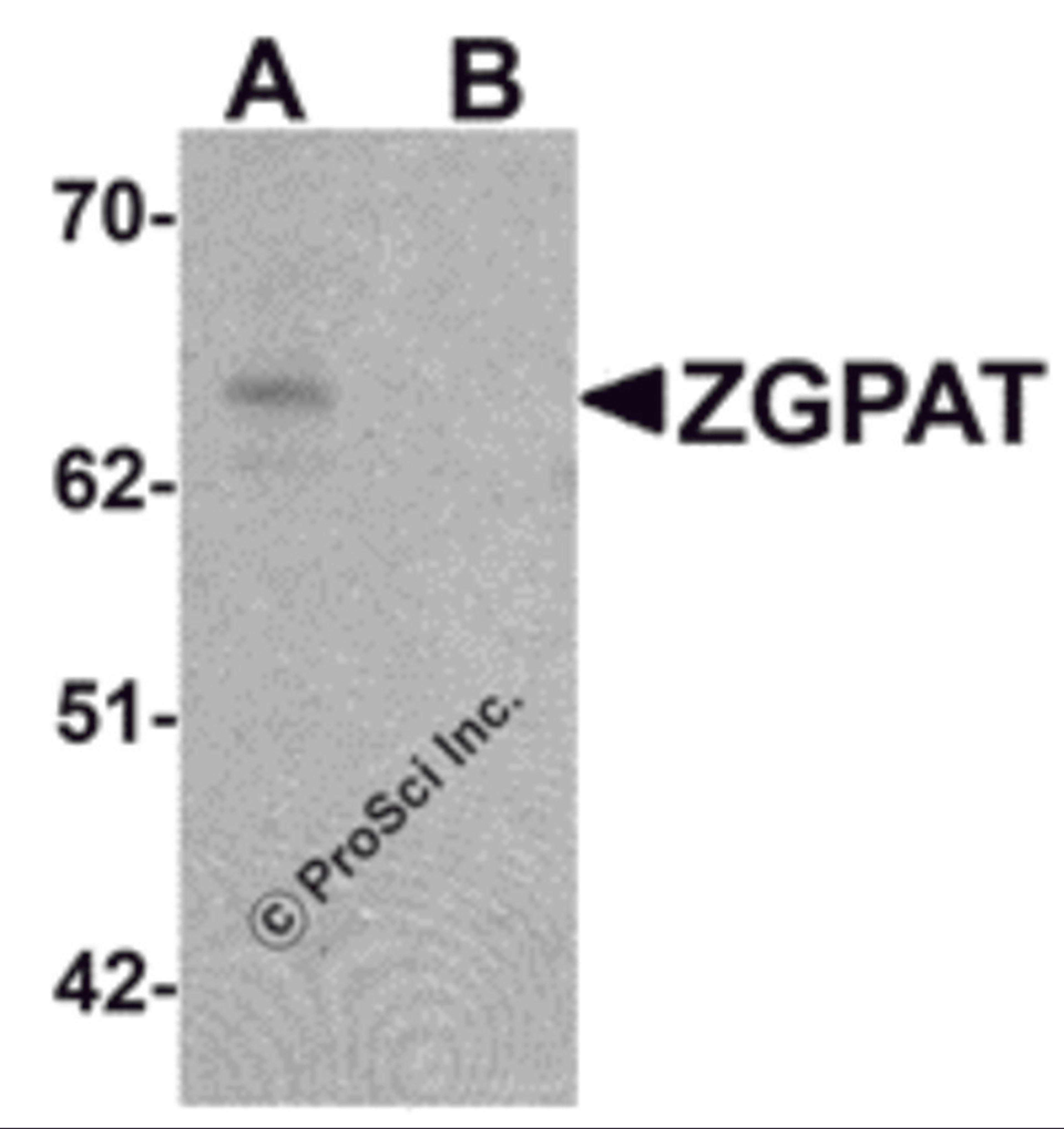 Western blot analysis of ZGPAT in SK-N-SH cell lysate with ZGPAT antibody at 1 μg/mL in (A) the absence and (B) the presence of blocking peptide.