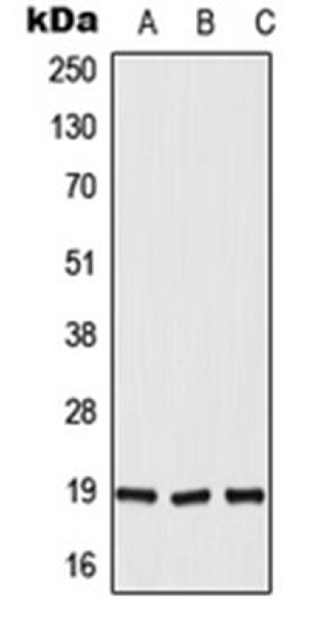 Western blot analysis of HepG2 (Lane 1), H9C2 (Lane 2), rat liver (Lane 3) whole cell lysates using DUX5 antibody