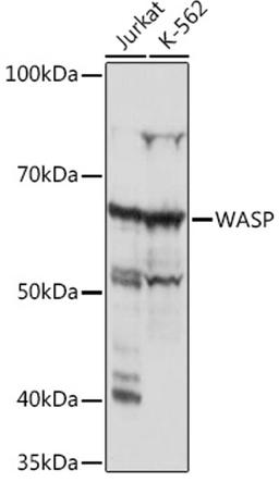 Western blot - WASP Rabbit mAb (A5132)