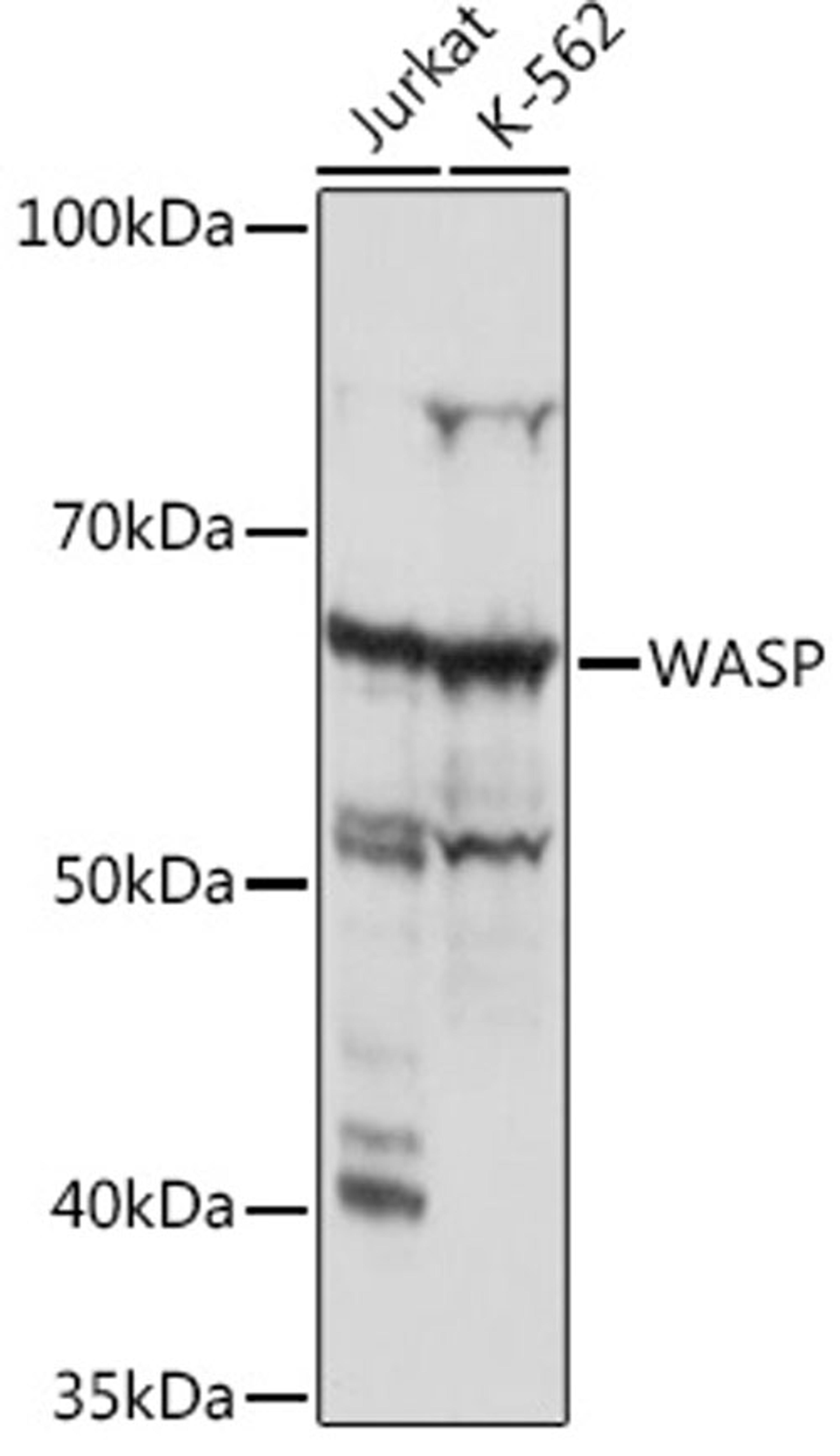 Western blot - WASP Rabbit mAb (A5132)