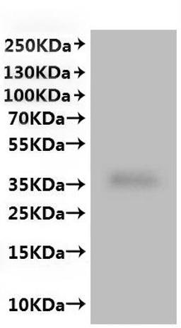 CSB-MP622519HU(A4) is detected by Mouse anti-6*His monoclonal antibody.