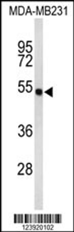 Western blot analysis of FLAD1 Antibody in MDA-MB231 cell line lysates (35ug/lane)