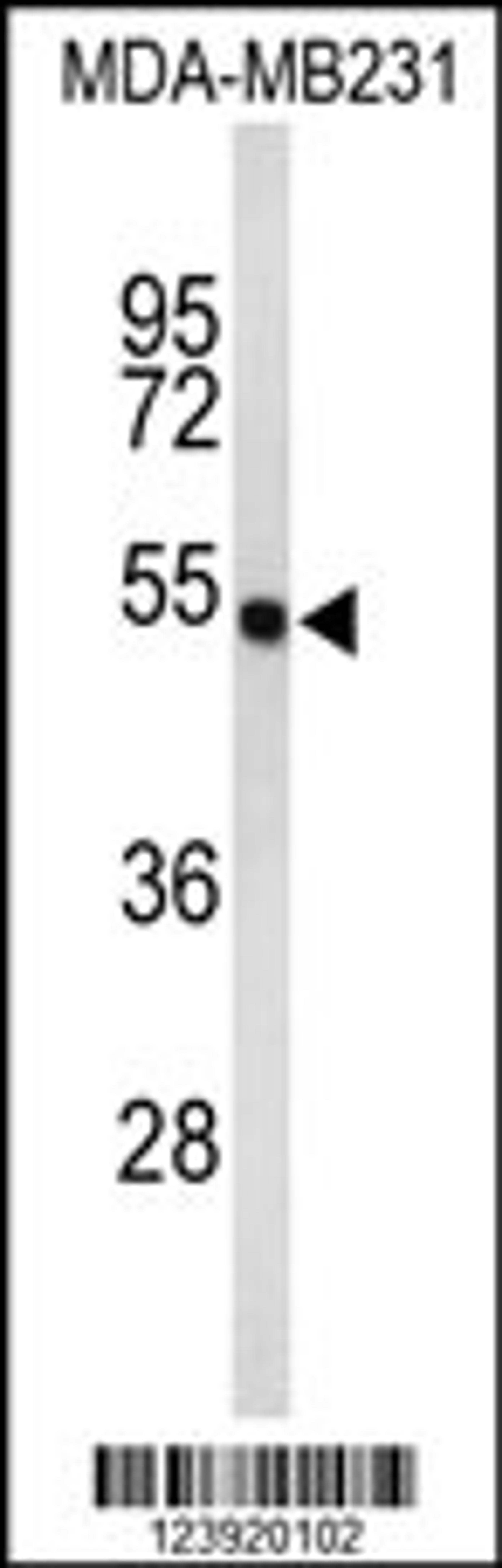 Western blot analysis of FLAD1 Antibody in MDA-MB231 cell line lysates (35ug/lane)