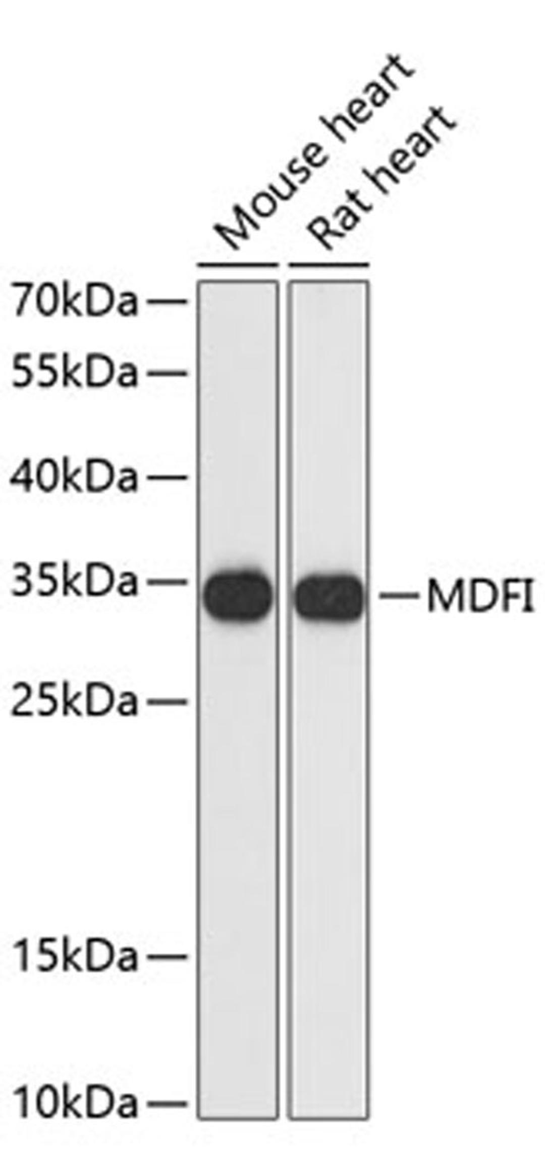 Western blot - MDFI antibody (A13709)