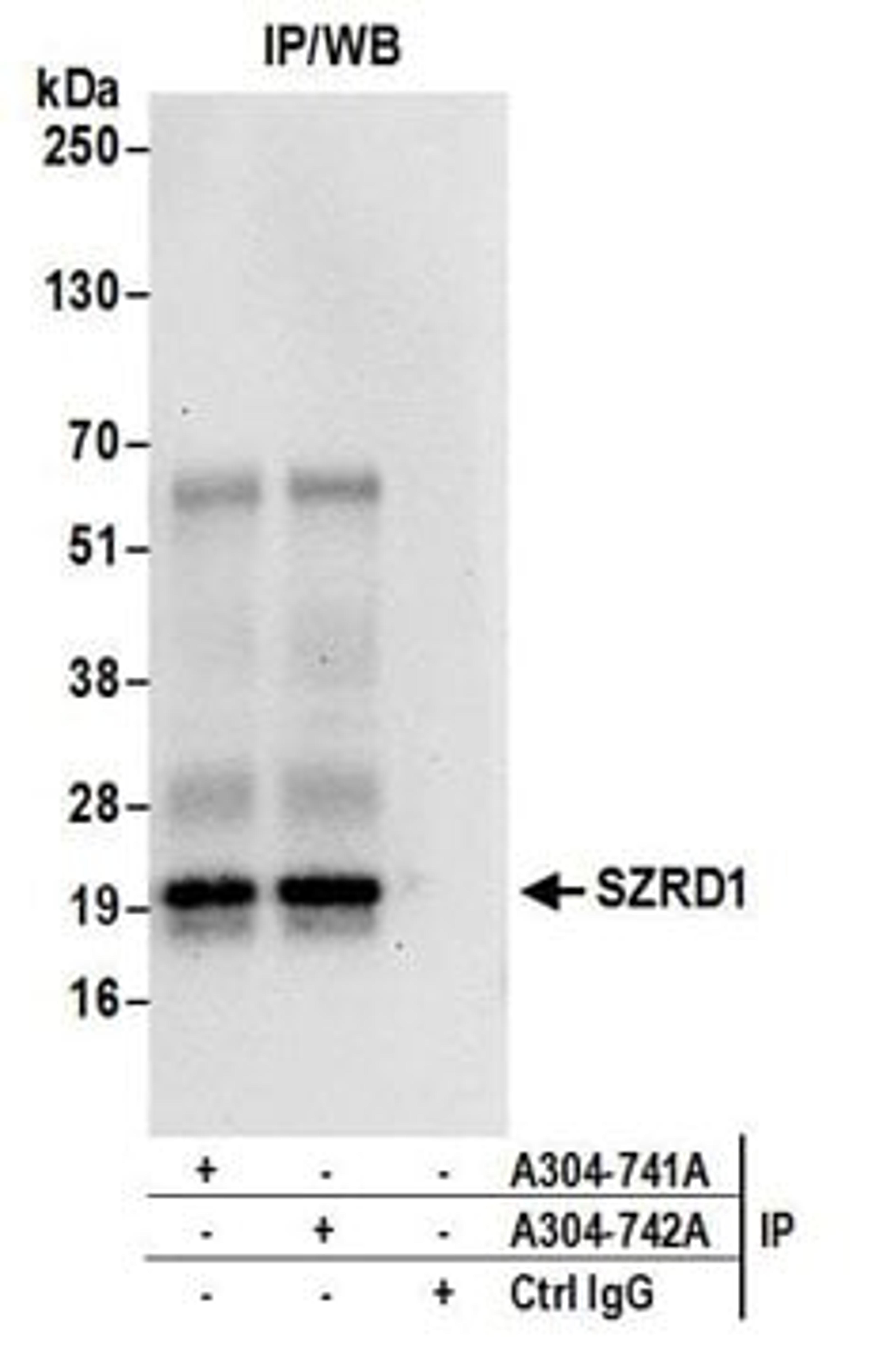 Detection of human SZRD1 by western blot of immunoprecipitates.