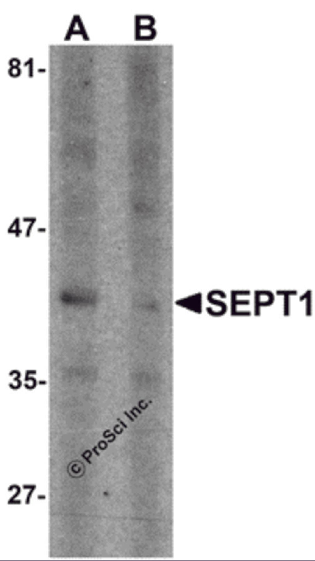 Western blot analysis of SEPT1 in Raji cell lysate with SEPT1 antibody at 1 μg/ml in (A) the absence and (B) the presence of blocking peptide.