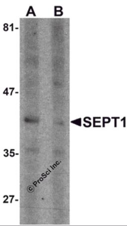 Western blot analysis of SEPT1 in Raji cell lysate with SEPT1 antibody at 1 μg/ml in (A) the absence and (B) the presence of blocking peptide.