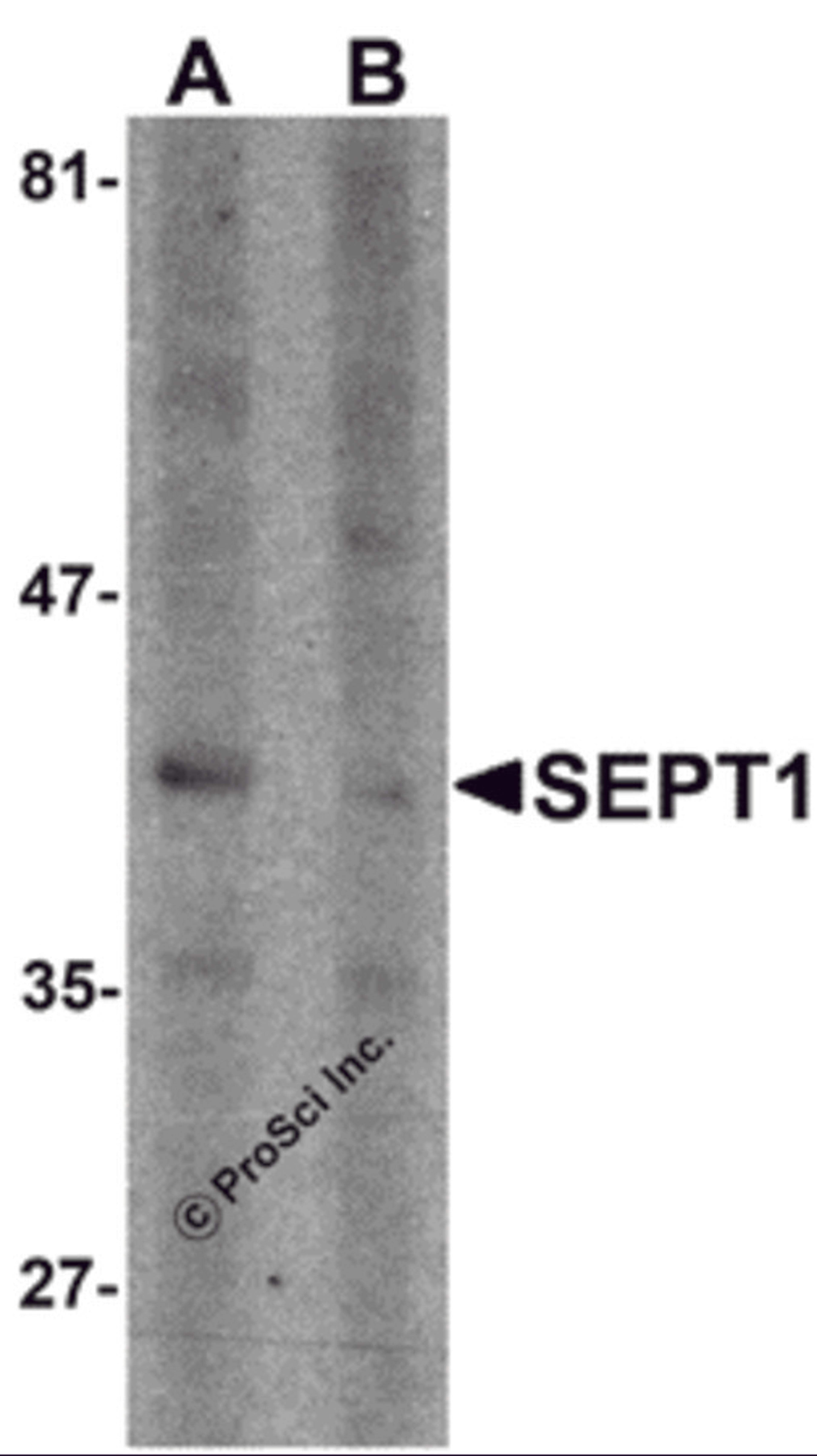 Western blot analysis of SEPT1 in Raji cell lysate with SEPT1 antibody at 1 μg/ml in (A) the absence and (B) the presence of blocking peptide.