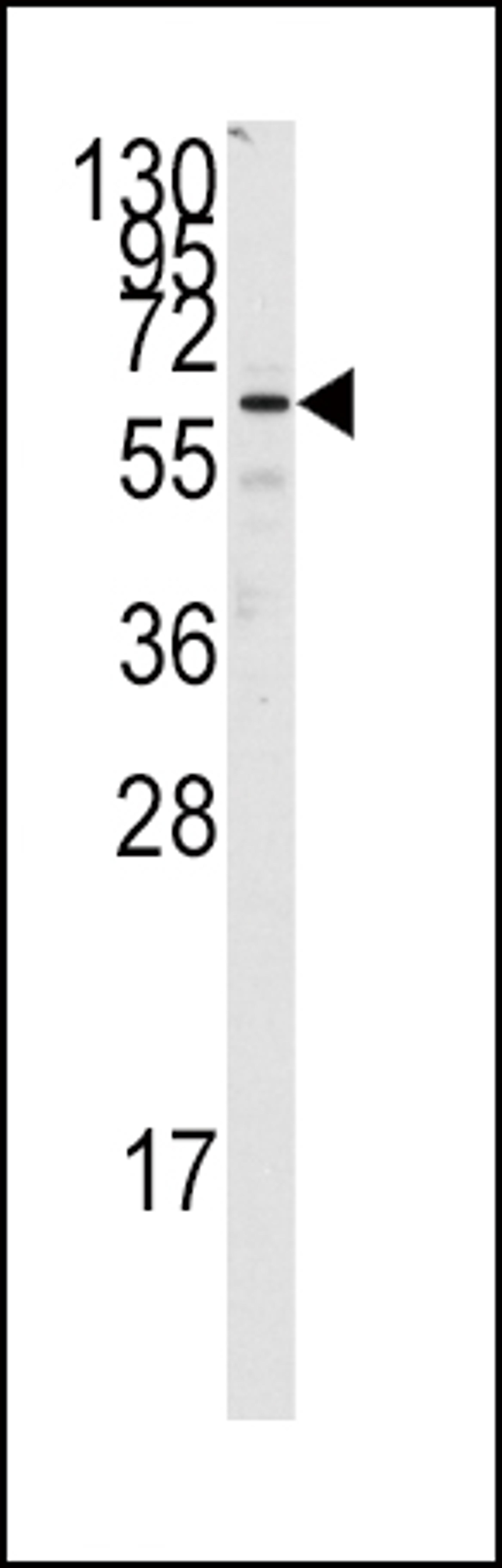 Western blot analysis of anti-FZD1 Antibody in Jurkat cell line lysates (35ug/lane)